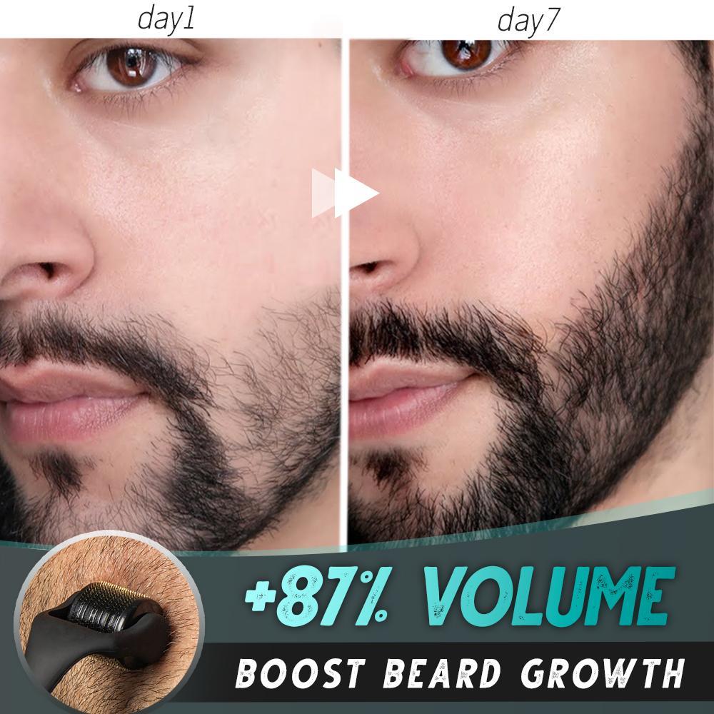 Beard Growth Roller Set - Babaloo