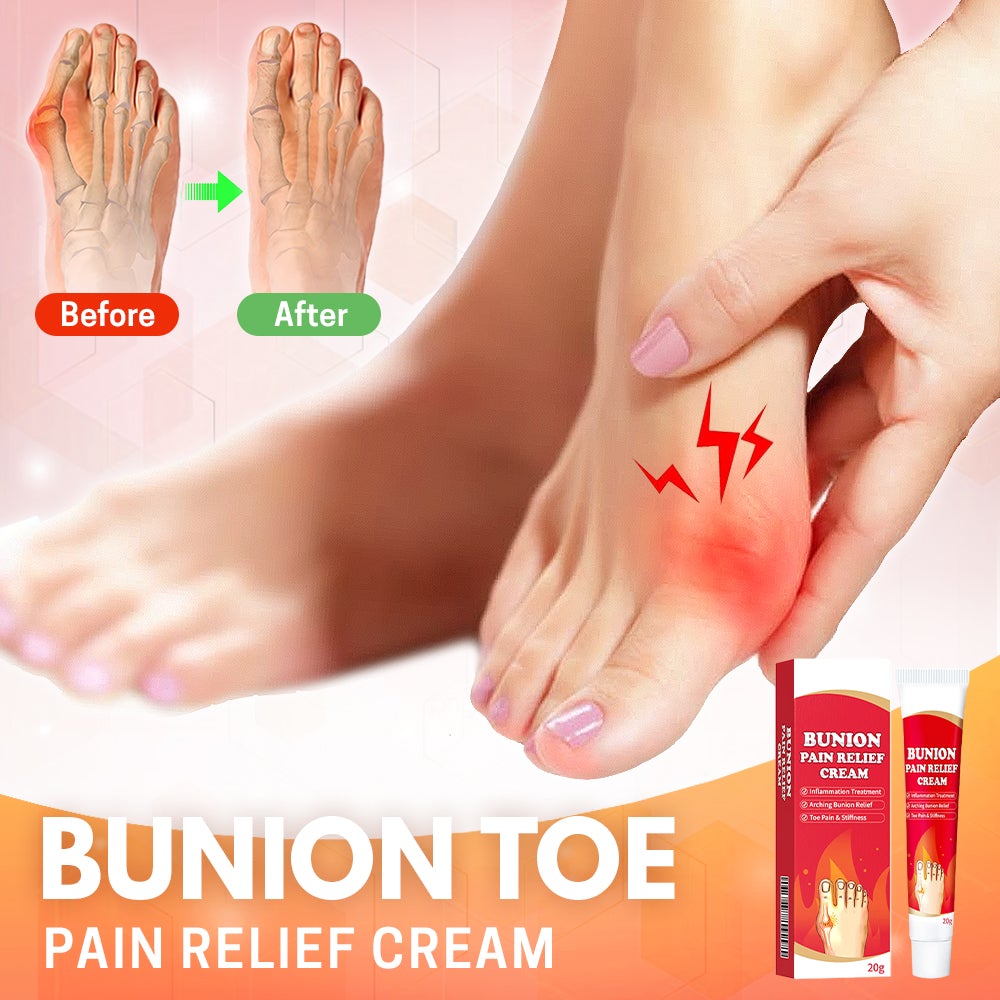 Bunion Toe Relief Cream - Babaloo